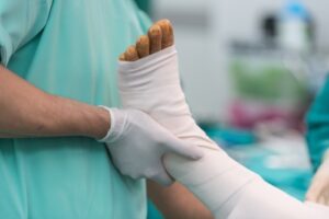 How to Pursue Compensation for an Amputation Injury Caused by Negligence